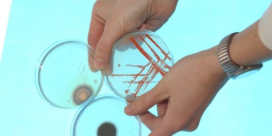 Three Petri dishes with different fungal cultures are held by two hands.