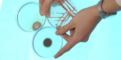 Drei Petrischalen mit unterschiedlichen Pilzkulturen werden von zwei Händen gehalten.